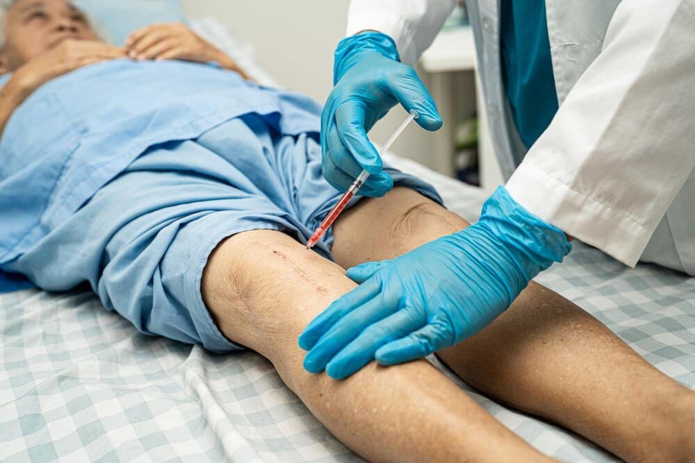 Skleroterapia: Efekty, Bezpieczeństwo i Pielęgnacja Po Zabiegu